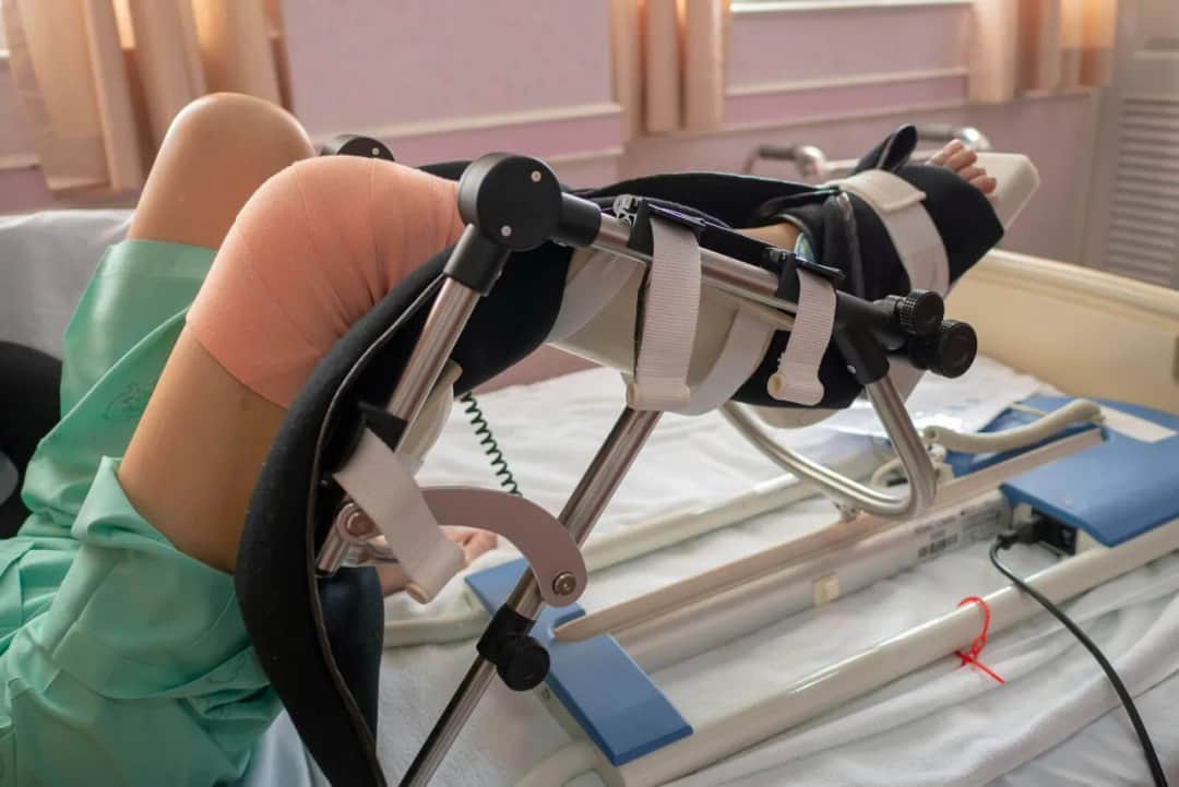 Kiedy rehabilitacja po endoprotezie kolana? Kluczowe informacje i porady