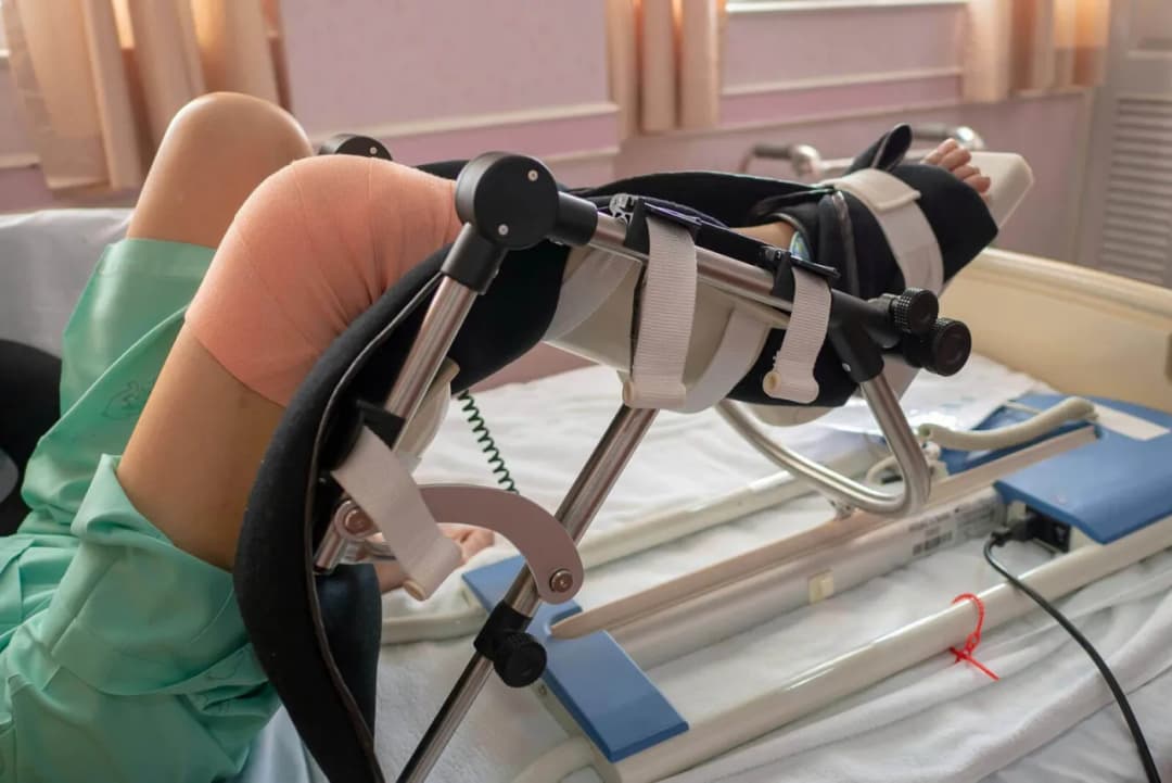 Kiedy rehabilitacja po endoprotezie kolana? Kluczowe informacje i porady